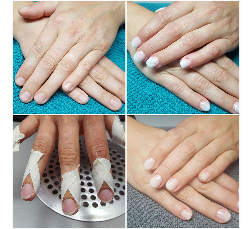 Kaunägel Serie bis schöne gepflegte Fingernägel