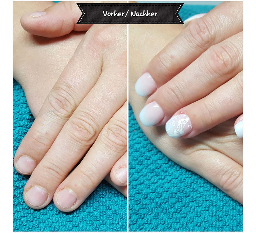 Fingernägelkauen vorher_nachher