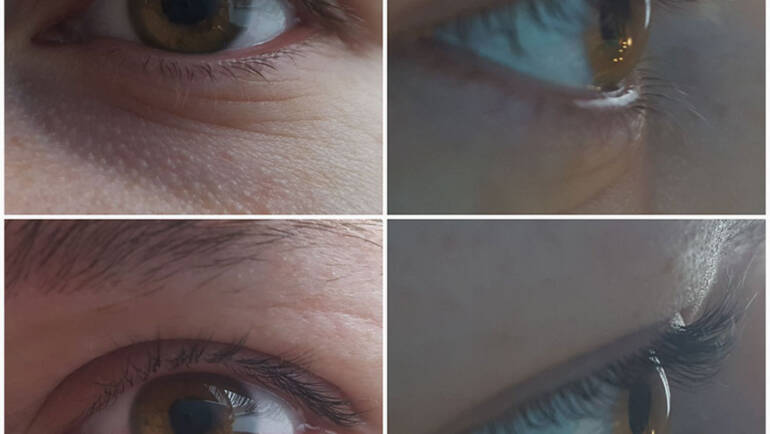 Lashlifting vorher und nachher