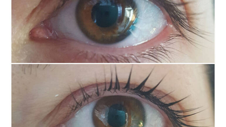 Lashlifting vorher und nachher