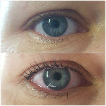 Lashlifting vorher und nachher